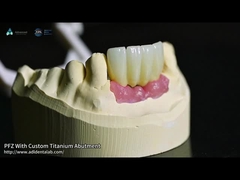 Sekrup Tetap Titanium Custom Abutment Porselen Digabungkan Dengan Zirconia