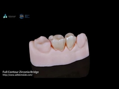 Natural Full Contour Zirconia Crown Precise Fit Full Contour Dental Lab