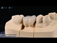 Warna Gigi Alami Seramik Feldspathic Veneer Untuk Gigi Depan dan Belakang