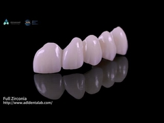 Translucence Tinggi Full Contour Zirconia Jembatan Resistensi Chipping Estetika Alam