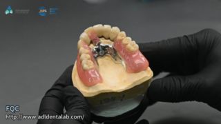 Kualitas Penyolderan Presisi Mahkota Teleskop