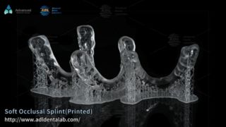 Custom 3D Printed Night Guard for Teeth Grinding Relief