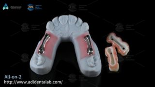 Premium Titanium Implant Bar for All On X Dentistry