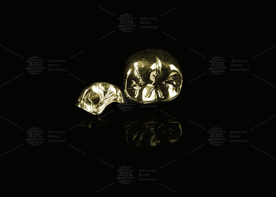 Beli Perpaduan Emas Emas Kuning 60% Full Metal Crown Emas Finish Full Metal Crown pembuatan online