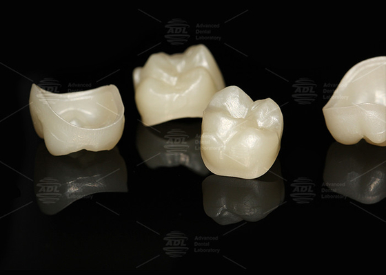 Beli Natural Full Contour Zirconia Crown Precise Fit Full Contour Dental Lab pembuatan online