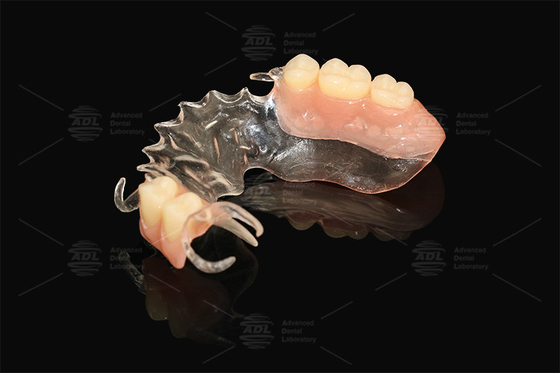 Beli Vertex Jelas Fleksibel Parsial Hampir Tidak Bisa Runtuh Risiko Alergi Rendah Dental Parsial Lengkap pembuatan online