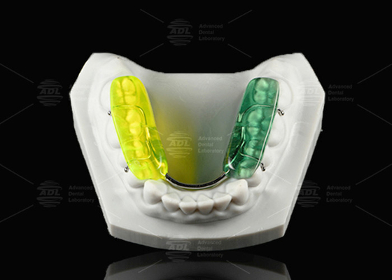 Beli Gelb Berwarna-warni Splint Gigi Hard Acrylic Resin Occlusal Splint Untuk Giling Gigi Malam pembuatan online
