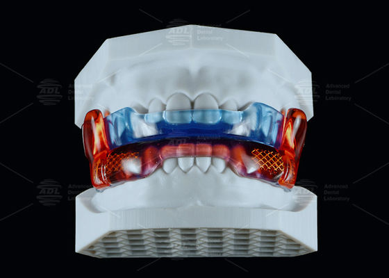 Beli Peralatan Anti Mendengkur Silikon Kelas Medis RP Untuk Meningkatkan Tidur pembuatan online