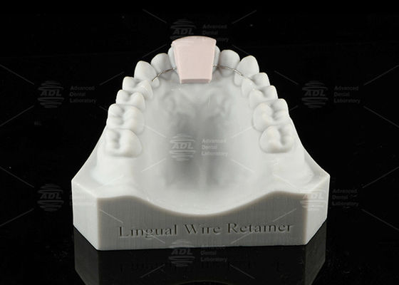 Beli Wire tongue retainer yang tidak bisa dilepas Invisible Direct Bonded Tongue retainer wire pembuatan online