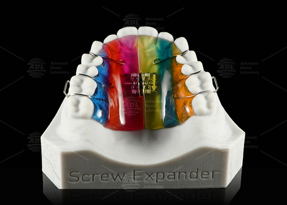 Beli Ekspansi Gigi Dan Distalasi Palate Expander Ortodontik Expander pembuatan online