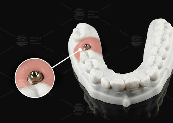 Beli Perak Emas Titanium Multi Unit Abutment Untuk Single atau Multi Unit Platform Prosthetic pembuatan online