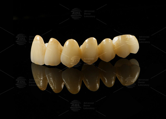 Beli Porselen yang Kuat dan Estetis yang Digabungkan dengan Zirconia untuk Restorasi yang terlihat alami pembuatan online