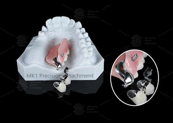 Beli MK1 Perlengkapan Gigi Prothesis Perak Bagian Gigi Praktis Perlengkapan Gigi pembuatan online