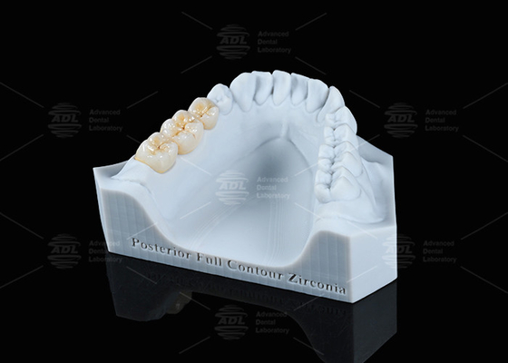 Beli Translucence Putih Full Contour Zirconia Crown FCZ Monolitik Zirconia Crown Mudah Penggilingan pembuatan online