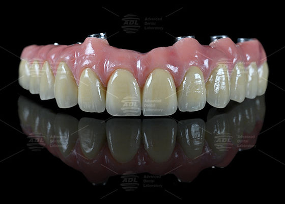 Beli China Dental Lab Hybrid Bridge Implant Bar Malong Design Screw Retained Or Cemented Metode Pemasangan Untuk Aplikasi Gigi Presisi pembuatan online