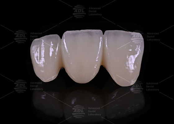 Beli China Dental Laboratory Precision Precision of Margins Layered Zirconia Hypoallergenic Biocompatible Dental Material untuk tahan lama dan restorasi pembuatan online