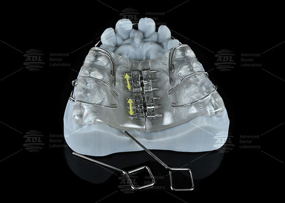 Beli China Lab Gigi Berwarna-warni Stainless Steel Screw Expander untuk Maxilla dan Expansion mandible pembuatan online