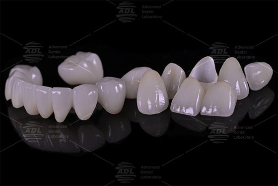 Beli China Dental Laboratory Porcelain Digabungkan Dengan Zirconia Kekuatan Tinggi Menyediakan Layanan yang Disesuaikan Untuk Laboratorium Gigi Internasional Dan Dokter Gigi pembuatan online