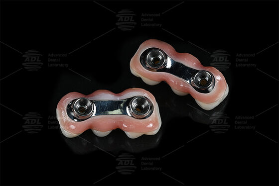 Beli Penguatan Implant Bar CAD CAM Dirancang Untuk Keakuratan Pas Kompatibel Dengan Sebagian Besar Sistem Implantasi Gigi Memastikan Solusi Restorasi Gigi Laboratorium Gigi Cina pembuatan online