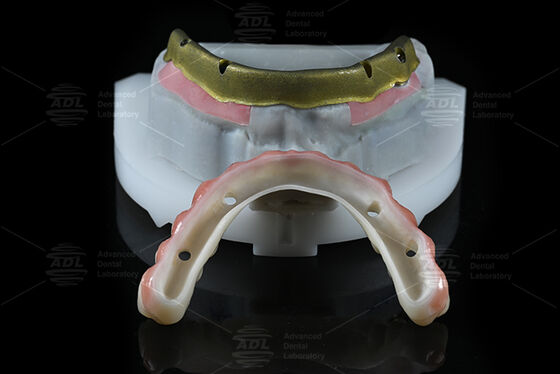 Beli China Dental Laboratory Kompatibel dengan sebagian besar sistem implan gigi Semua pada 4 Menawarkan dalam waktu 72 jam Waktu dan Array Parameter teknis pembuatan online