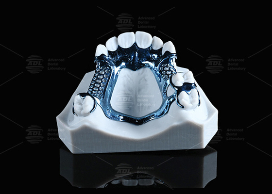 Anodized 3D Cetak Titanium Frame Ringan Dan Cocok Untuk Kulit Sensitif