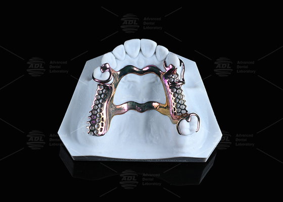 Kulit Sensitif Kerangka Titanium Kekuatan Tinggi Solusi Cetak 3D