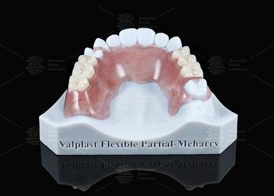 Valplast Ringan Fleksibel Parsial Dengan Retensi Yang Sangat Baik Di Pink Dan Meharry