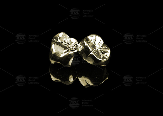 Elegant Full Cast Metal Crown Perhiasan Emas 20% Polished Full Metal Dental Crown