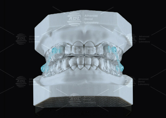 Transparan Erkodent Silensor Anti Mendengkur Mouthpiece Custom Fit Pengurangan Kebisingan