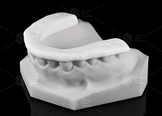 Ketahanan dan daya tahan 3D Nylon Occlusal Splint / Night Guard untuk gaya hidup aktif