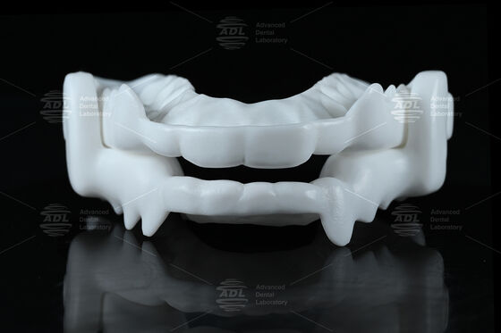 Pelindung Gigi Malam Okusal Berkualitas Medis dari Nilon dengan Desain CAD/CAM Fleksibel untuk Perlindungan Bruxism
